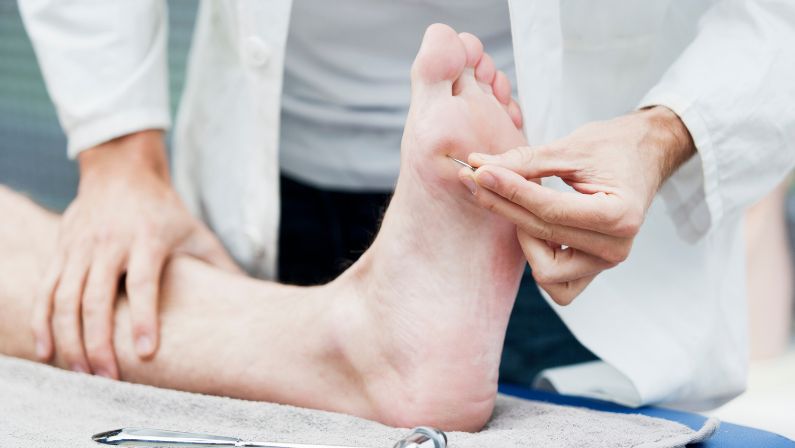 Benefits of Foot Mobilisation